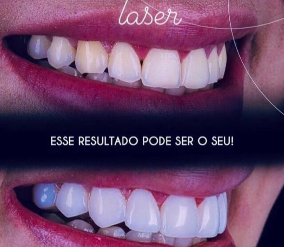 teste